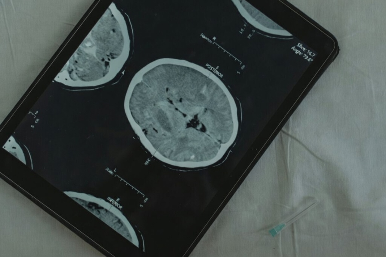 What Years of Poor Sleep Can Do to Your Brain and Body