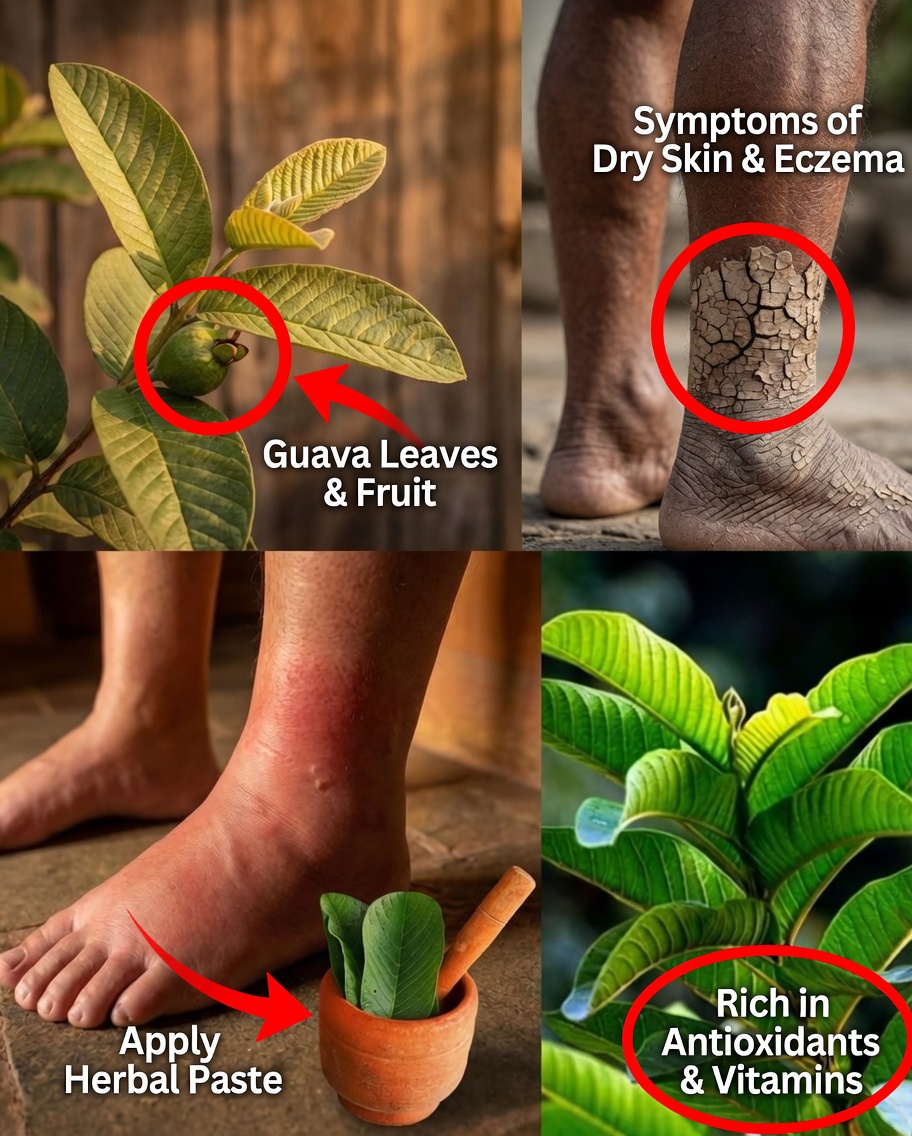 The Green Leaves That Melt Away Swollen Ankles Overnight