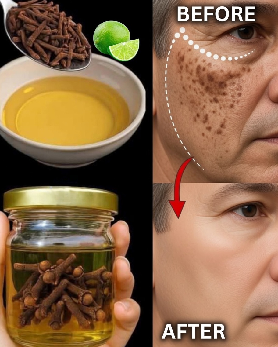 Erase Wrinkles and Pigmentation with This Trick