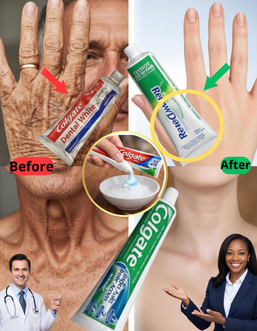 “It Looks Like I’ve Had Plastic Surgery”: The Home Remedy Used to Improve the Appearance of Wrinkles and Brown Spots on the Hands and Arms