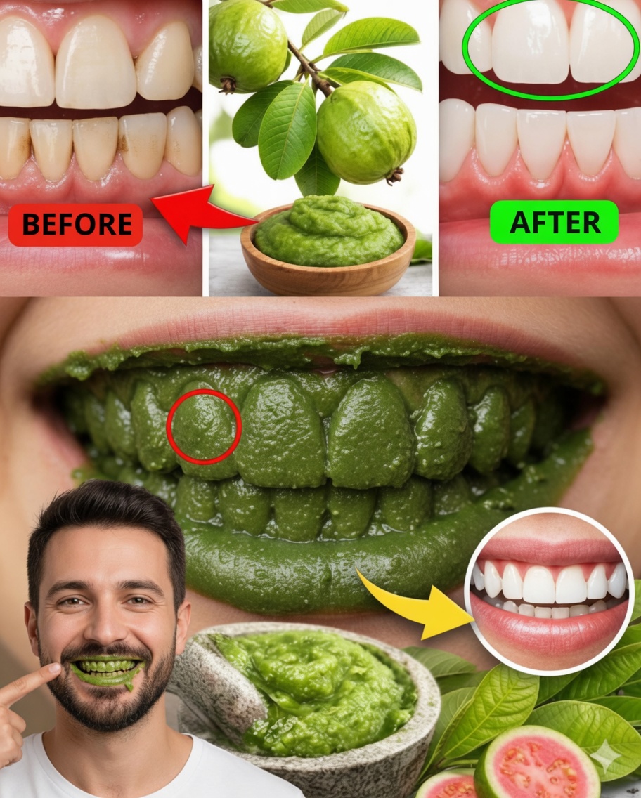 The Natural Secret of Your Smile: Guava Leaves Against Cavities