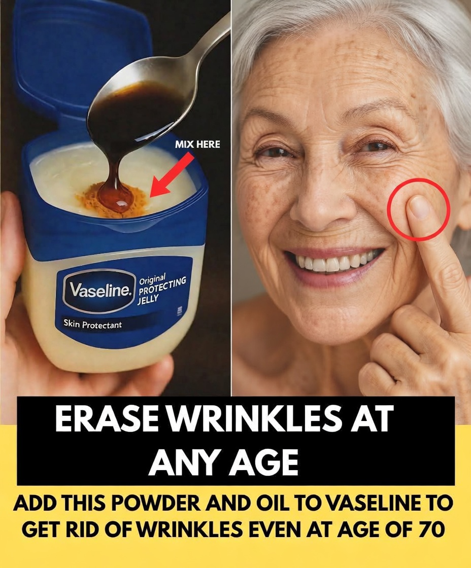 Vaseline’s Magic Recipe for Removing Wrinkles at Any Age – Even After Seventy!