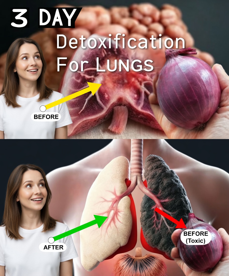 Clean Your Lungs: Stop Coughing in Three Days! Bronchitis Recipe