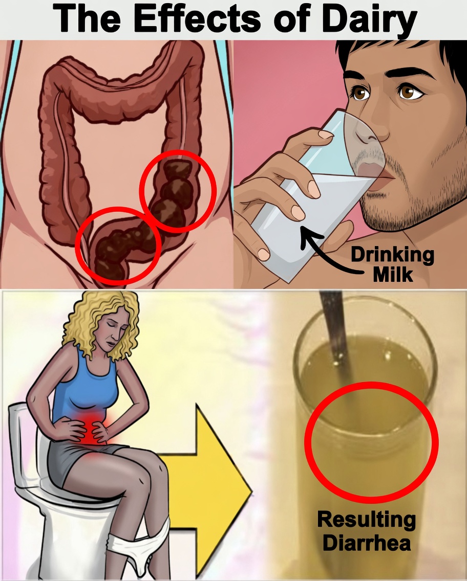 Just 1 spoon in the morning loosens all stool for 7 days within 3 hours and cleans the colon.