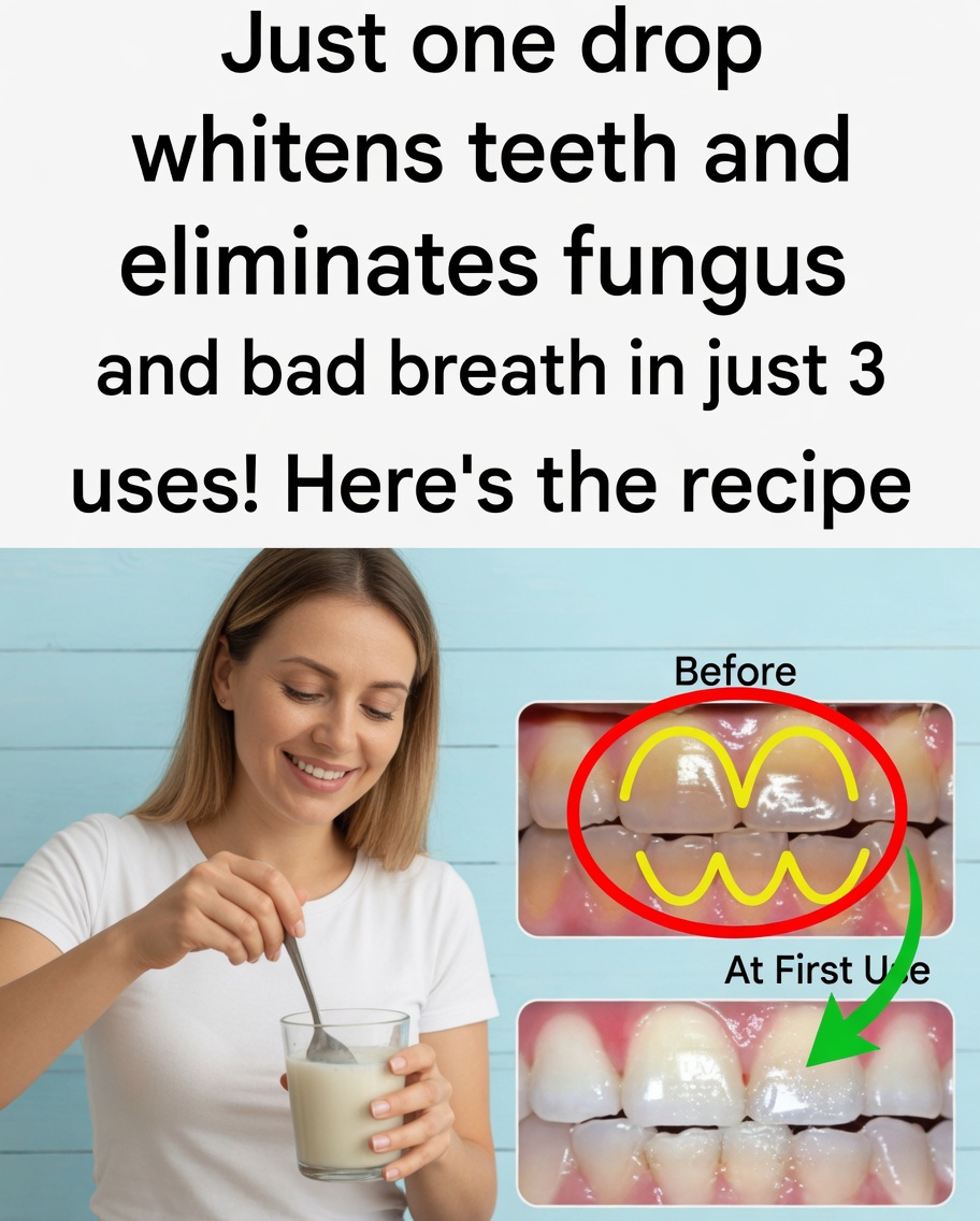 Remove Tartar From Your Teeth and Whiten Them With This Simple Recipe