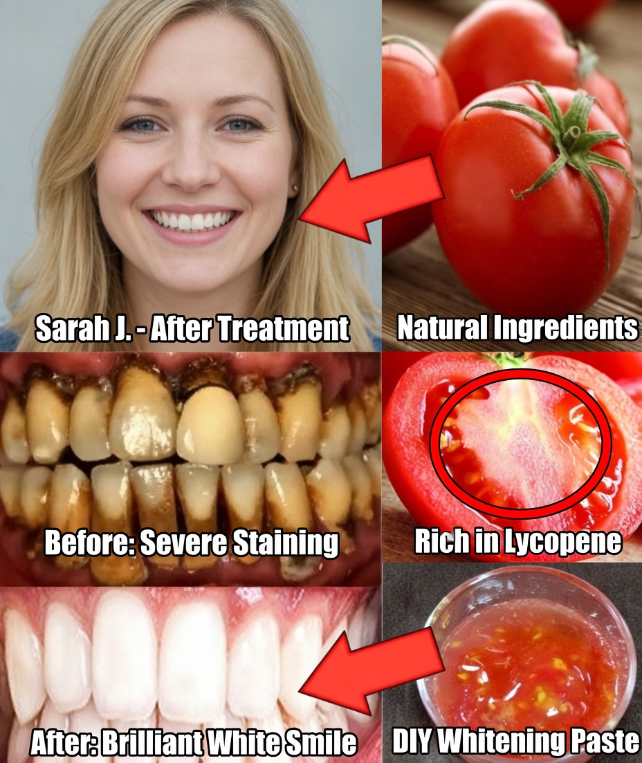 The Strongest At-Home Teeth Whitening Recipe in 2 Minutes: Naturally Whitening Yellow Teeth from Tartar with Tomatoes and…
