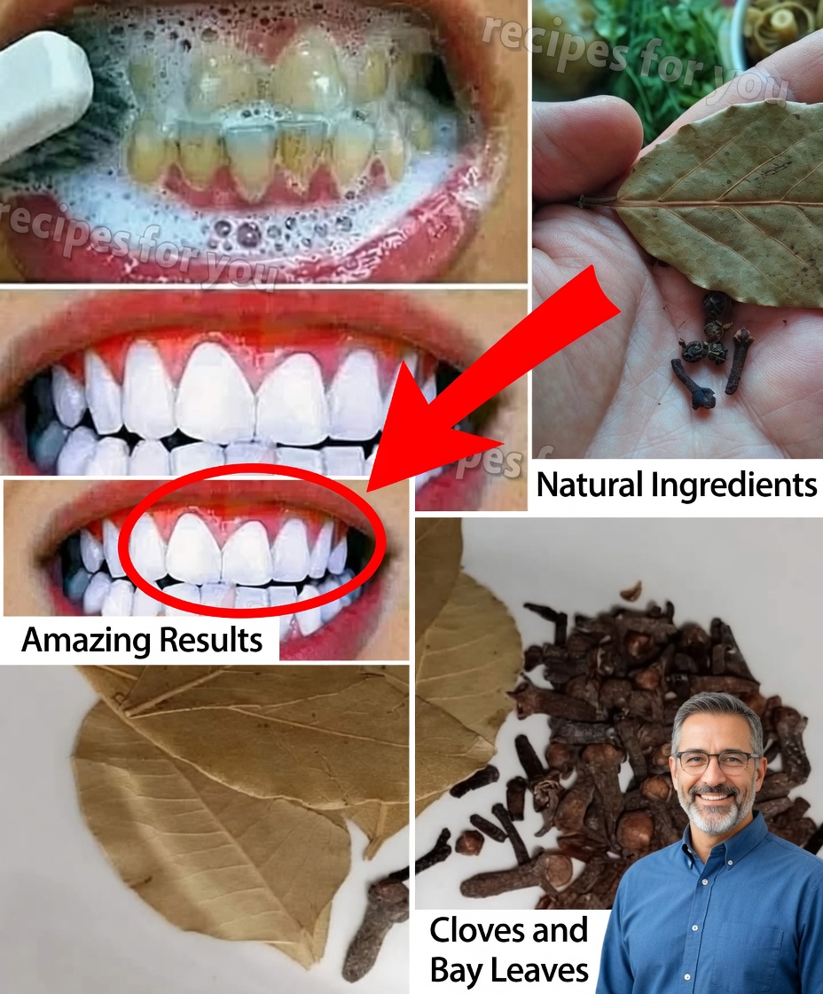 How to Use Bay Leaves and Cloves for Dental Care: