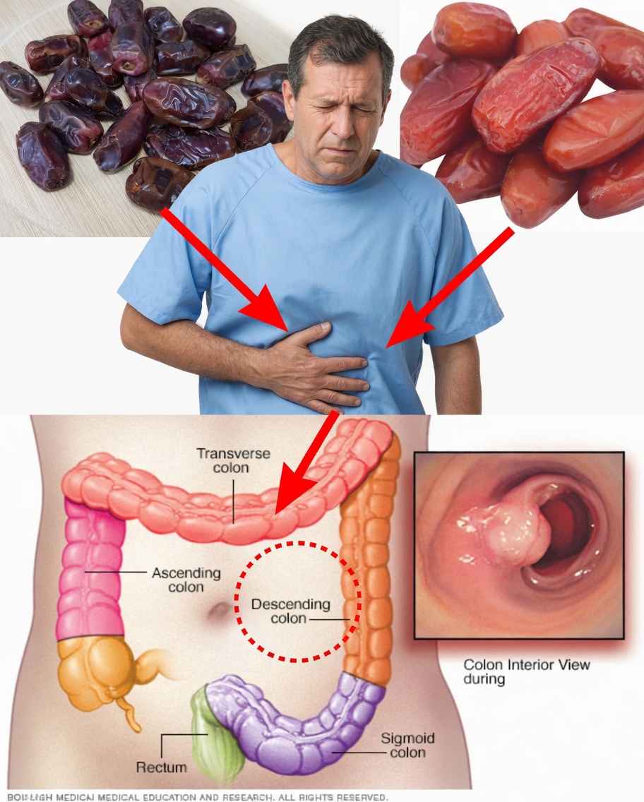 Using Dates to Cleanse Your Intestines: A Natural Detox Method